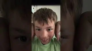 Fart