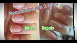 UNHAS GRANDES EM 2 DIAS