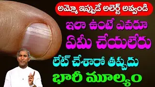 Nail 🥵🥵 అమ్మో ఇప్పుడే చెక్ చేసుకోండి ఇలా ఉంటే నేను కూడా ఏమి చేయలేను | Dr Manthena Satyanarayana Raju