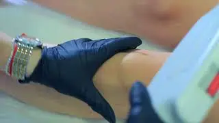 Ноги эпиляция Девушка