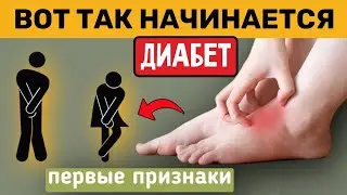 Еще нет диабета, но ... есть 10 признаков высокого сахара! Что делать?