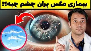 دیدن اجسام سیاه رنگ در میدان بینایی❌️ بیماری مگس پران‌ درمان داره؟!