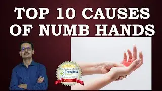 Top 10 causes of Numbness in Hand