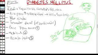 DİABETES MELLİTUS 2 ( TANISI , PATOGENEZ , TİP1 , TİP2 AYRIMI )
