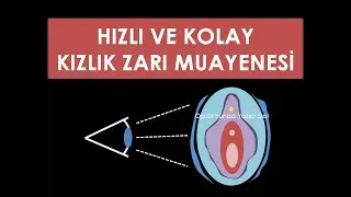 🟡 Kolay ve Hızlı Kızlık Zarı Muayenesi - Op. Dr. Funda Yazıcı Erol