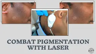 Multiple skin problems - One solution - Laser toning treatment
