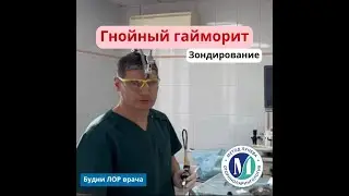 Зондирование (Лечение гайморита без прокола)