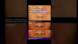 The New Skincare Ingredient That Changes EVERYTHING 🤯
