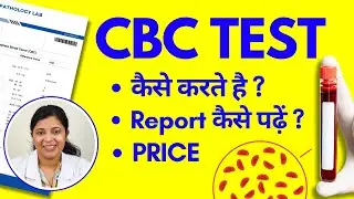 CBC Test Kya Hota Hai, Kaise Kiya Jata Hai? Report Kaise Padhe? Blood Test से क्या पता चलेगा?