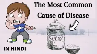 Why is Sugar the Most Common Cause of Disease (According to Science) | In Hindi