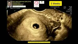 5 weeks