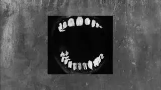 free dark kiraw type beat - ’sting’