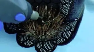 Sea Urchin Dental Procedure