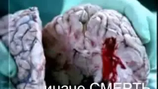 Курите? БРОСАЙТЕ...