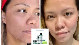 Miracle 30 days by SomeByMi( product review)