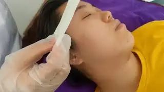 热玛吉临床操作2021 4 29