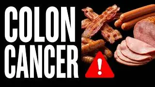 This Everyday FOOD Increases Colon CANCER Risk - What You Should Do (Doctor Explains)