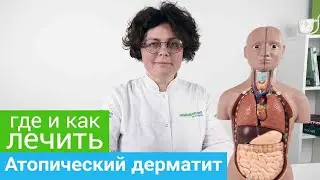 Где и как лечить АТОПИЧЕСКИЙ ДЕРМАТИТ.  Профильные курорты и методы санаторного лечения