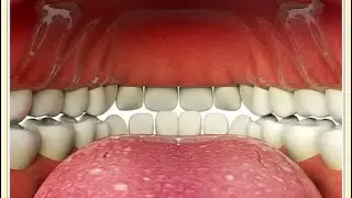 How to tell from your mouth if you are prone to snoring?