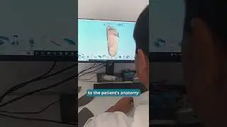 3D Printing Custom Foot Orthotics 👟