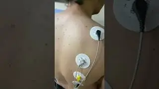 Ağrı Terapi Sistemi Calmare MC-5A Nasıl Kullanılır?