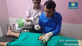 Uttar Basti By Dr.Sandeep Rane,For Urethral Structure Male Infertility And Prostate
