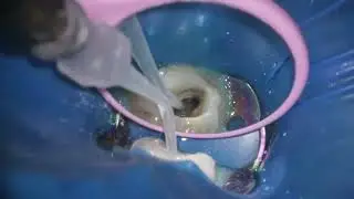 Communication between MB1 & 2 through microsuction