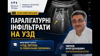 Приклади паралігатурних інфільтратів на ультразвуку