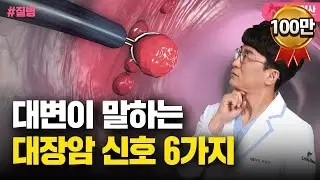 몸이 보내는 대장암 신호 6가지! 대변을 보면 대장암 증상 알 수 있습니다 한번쯤 꼭 확인하세요