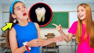 Someone knocked Out Suri's tooth in School !! | Jancy Family