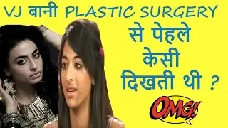 OMG! VJ Bani J Plastic Surgery Before and After SHOCKING Transformation Photos Full HD
