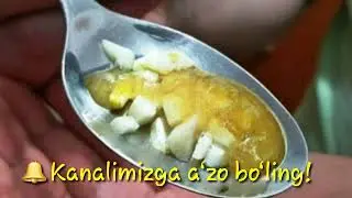 Oyoqda qon tomirlari kengayishi va suv yig‘ilishi