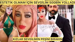 ESTETİK OLMAM İÇİN SEVGİLİM 500BİN YOLLADI