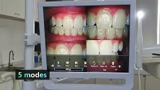S113 Intra Oral Camera+ Clamp+ 17” LCD Monitor