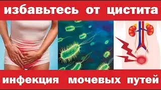 Как избавиться женщинам от ЦИСТИТА за 1 день. Первая помощь при приступе цистита