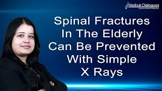 Spinal fractures in the elderly can be prevented with simple X rays