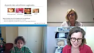 Webinaire GRIG / CNGOF Mycoses