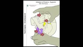 Craniosacral SBS on the Transverse Axes