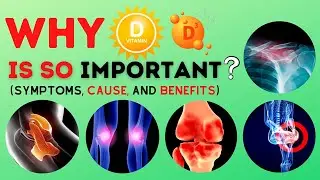 Why vitamin D is so important? | Vitamin D Deficiency(symptoms, cause, and benefits)