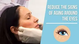 How to Treat Dark Circles,  Under-Eye Hollows & Bags, and Wrinkles Around the Eyes