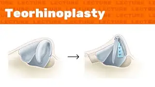Lecture: Teorhinoplasty