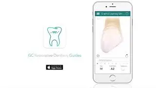 GС Resorative Guides - гид по выбору материалов для успешной реставрации