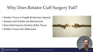 Rotator Cuff Surgery and Why It Fails