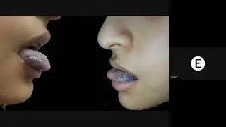 Charla de lesiones rojo azuladas