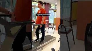 Post-Stroke Treadmill Training: A Path to Recovery and Mobility#brain #stroke #balance