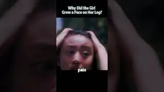 Why Did the Girl Grow a Face on Her Leg? 
