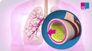 Hoe werken de longen: bronchiën