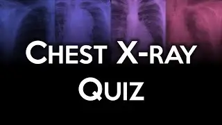 Chest X-ray Quiz Challenge