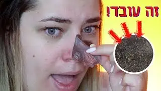 המסכה הטובה בעולם להוצאת שחורים מהאף ! OMG