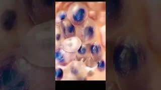 Skin पर तिल कैसे आ जाता हैं - science of mole #facts #science
